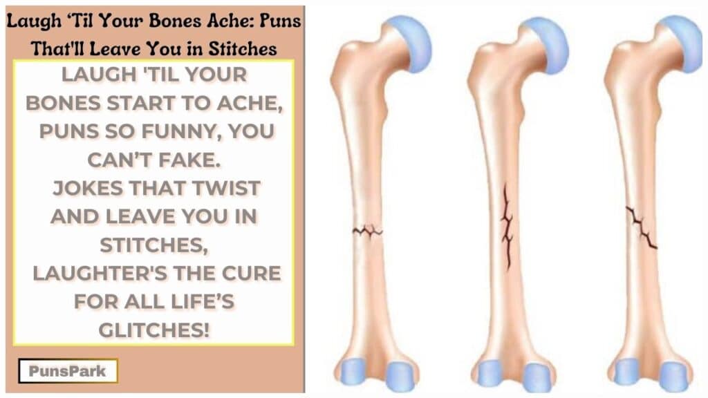 Bone Puns 